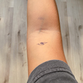 Midletidig tatovering bølger